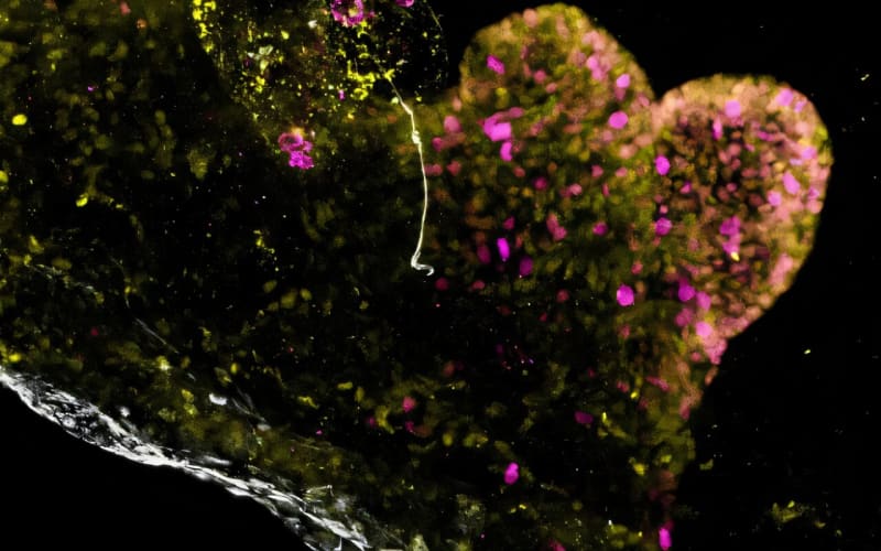 Scientists Grow Mini-Stomachs to Study Rare Diseases