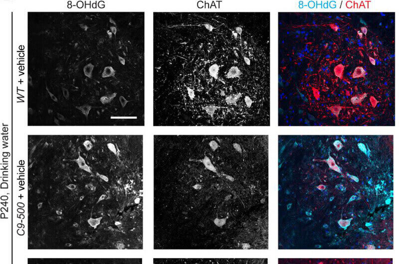 New ALS Treatment Crosses Brain Barrier in Mice Study - Image 2