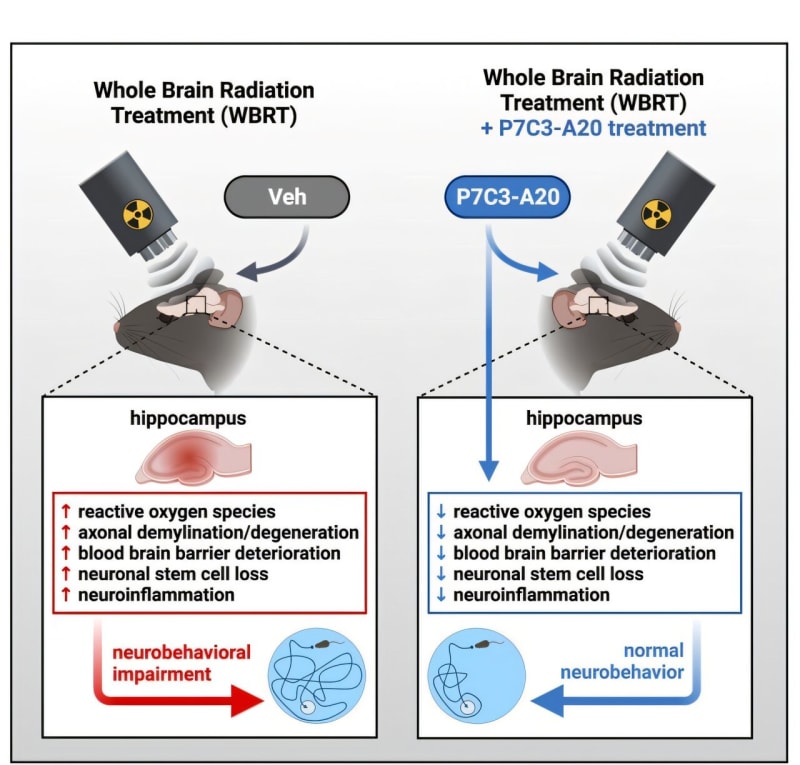 New Drug May Shield Brain From Radiation Side Effects