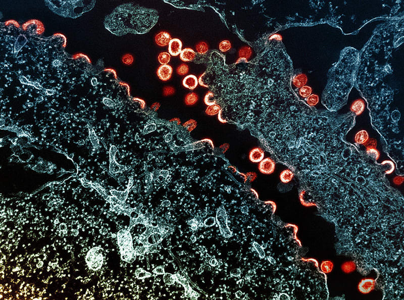 Kenya-Uganda Trial Cuts New HIV Cases by 70%