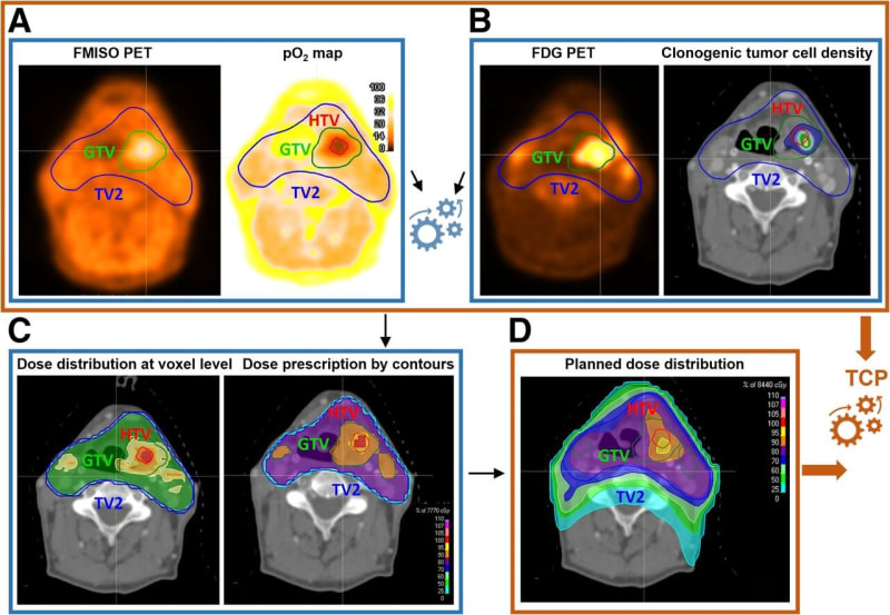 PET Scans Personalize Cancer Treatment, Boost Survival 90%
