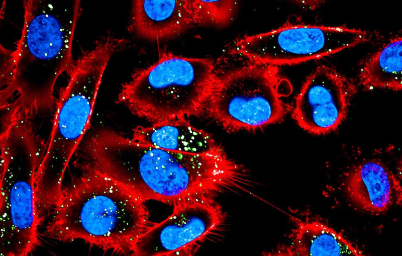 Finnish Scientists Find Way to Stop Melanoma's Growth Cycle - Image 2