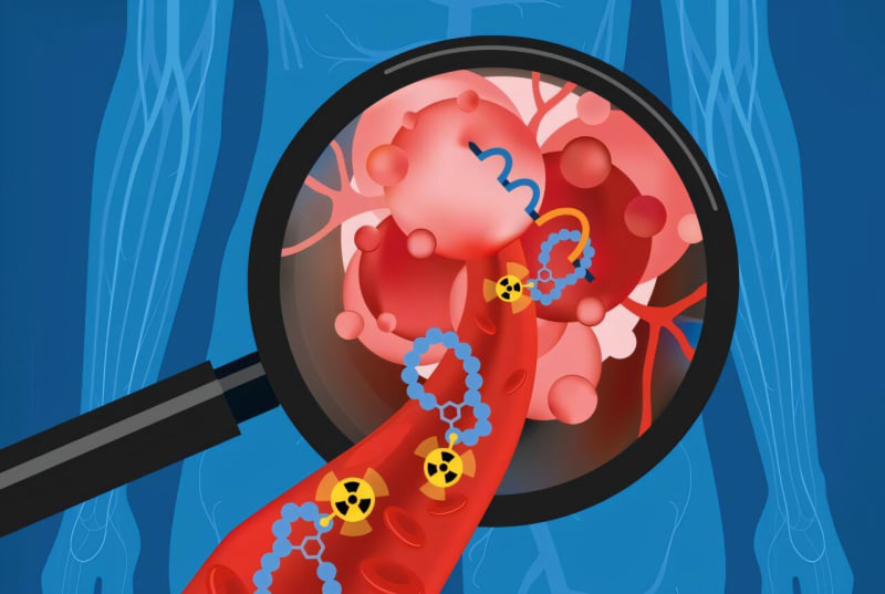 Breakthrough Imaging Tool Brings New Hope for Bladder Cancer Patients