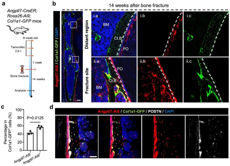 Scientists Find Special Cells That Heal Broken Bones - Image 2