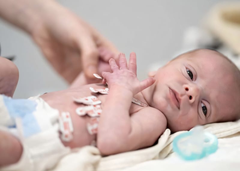 Young infant in hospital bed being monitored by traditional wired medical devices and sensors