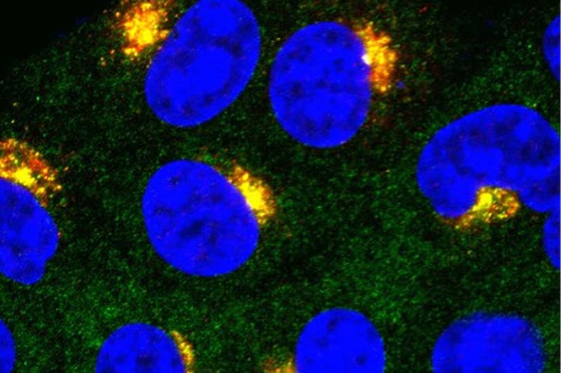 Scientists Find Key to Controlling Body's Immune Response