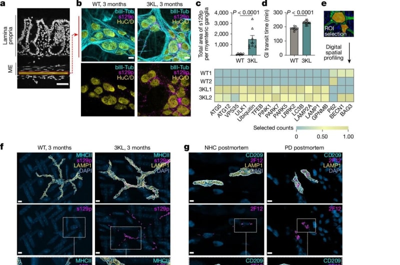Gut Immune Cells May Stop Parkinson's Before Brain Damage - Image 2