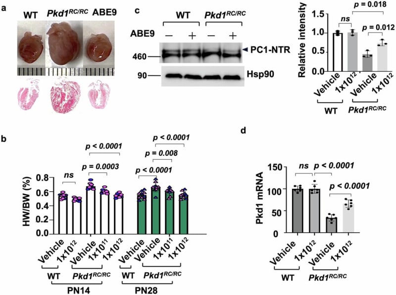 Single Gene Edit Treats Inherited Kidney Disease in Mice - Image 2