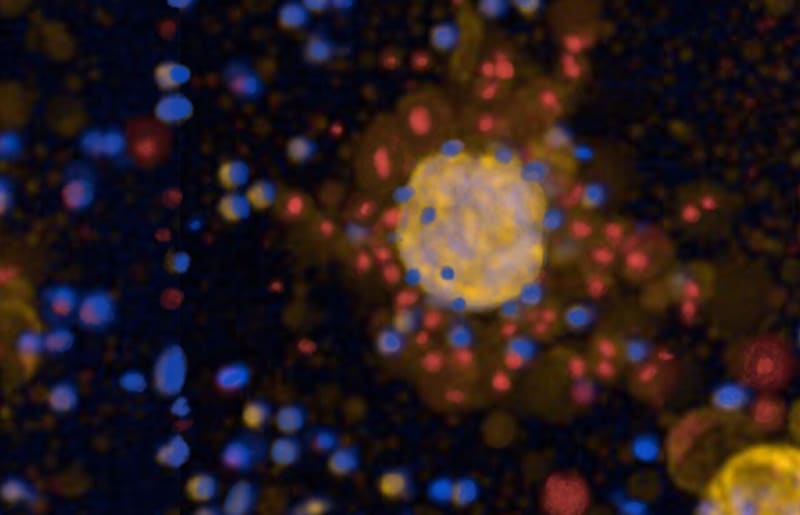 Lab-Grown Mini Tumors Could Personalize Lung Cancer Care - Image 2