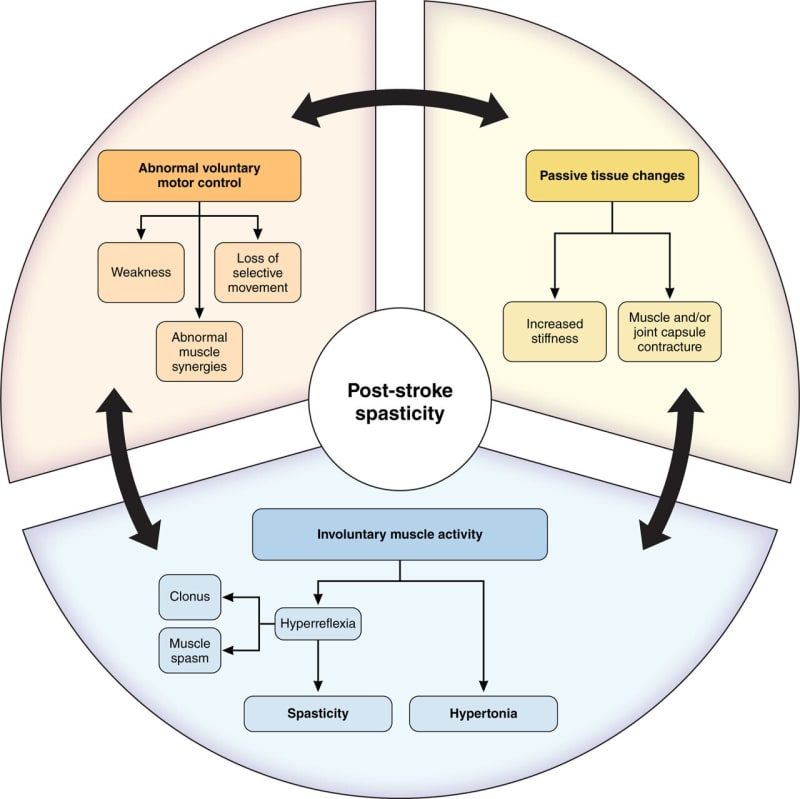New Guidelines Help Stroke Survivors Recover Movement Faster - Image 2