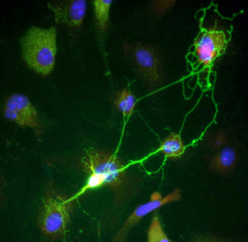 Scientists Crack Code of Chronic Pain Neurons