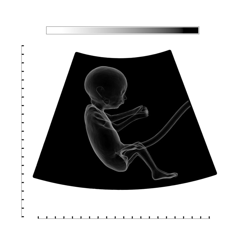 AI Detects Dangerous Pregnancy Condition Doctors Often Miss