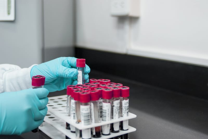 Blood Test Could Detect Alzheimer's Decades Early