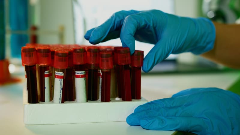 Blood Test May Predict Cancer Treatment Success in Young Men