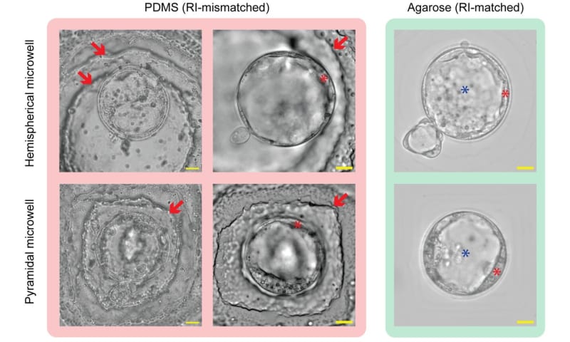 New IVF Dish Helps Doctors See Embryos 95% Clearer