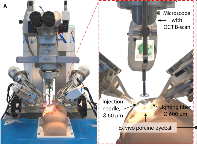 Robotic surgical system performing precise needle insertion into retinal vein during eye surgery procedure