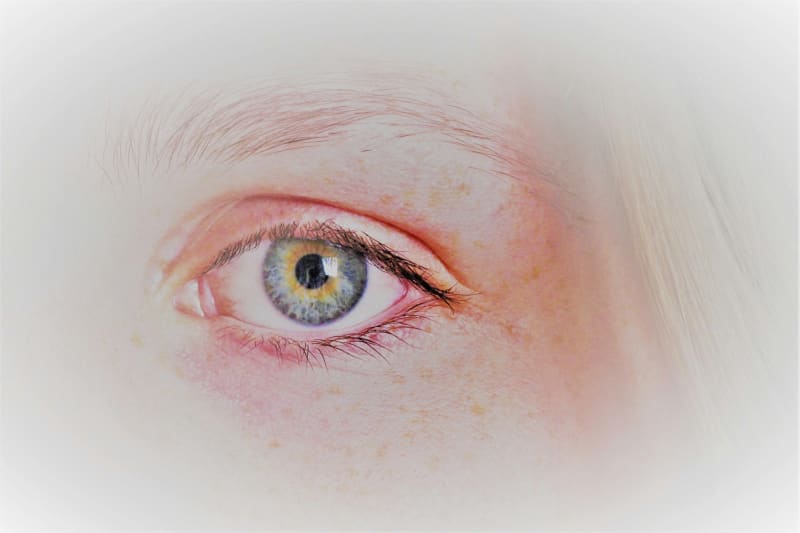 Simple 3-Question Tool Detects Brain Disorders Earlier