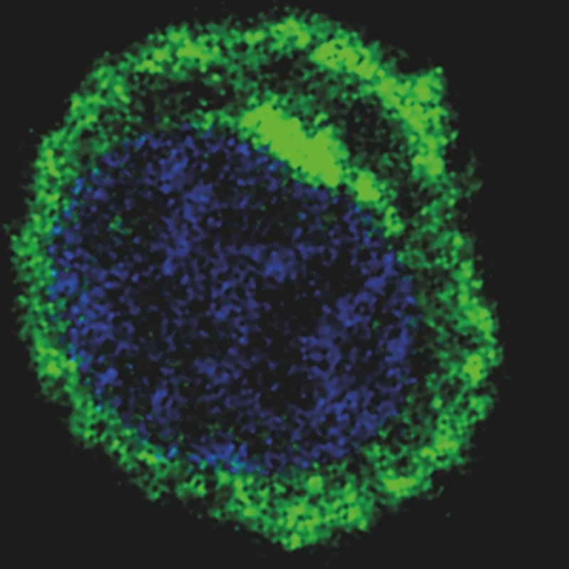 Cancer Drug Reawakens Failed Immunotherapy for 6 Patients