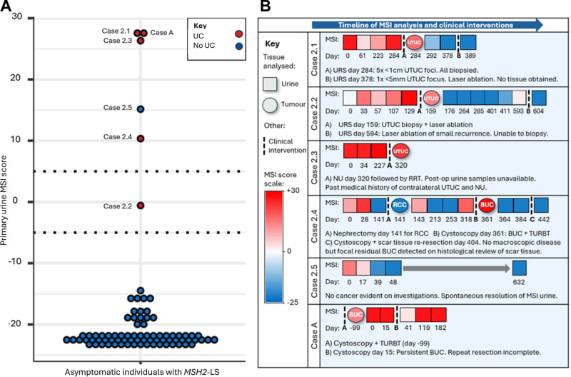 Simple Urine Test Detects Cancer Before Symptoms Appear