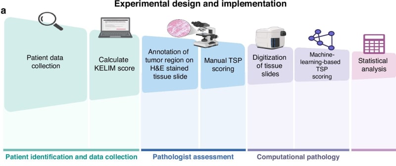 AI Tool Predicts Best Ovarian Cancer Treatment at Diagnosis