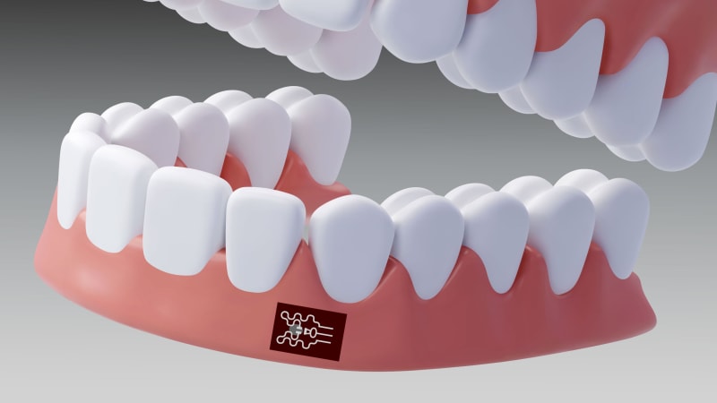 Mouth Patch Detects Gum Disease Before Symptoms Start
