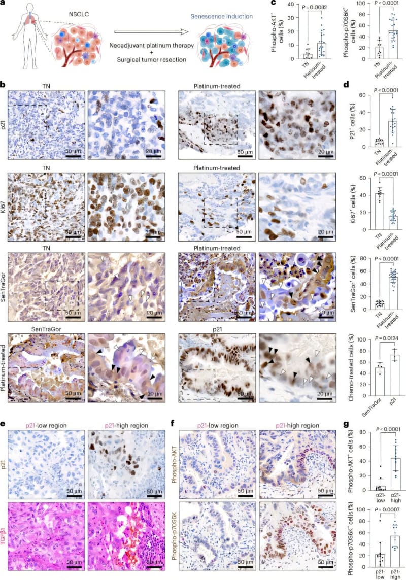 Scientists Find Way to Stop Chemo-Resistant Cancer Return
