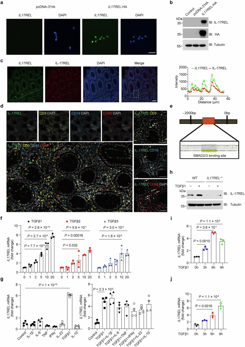 Scientific illustration showing IL-17REL decoy receptor protein binding to inflammatory molecules in intestinal tissue