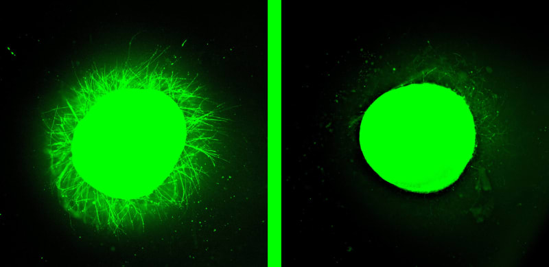 Dancing Molecules Repair Human Spinal Cord Tissue in Lab