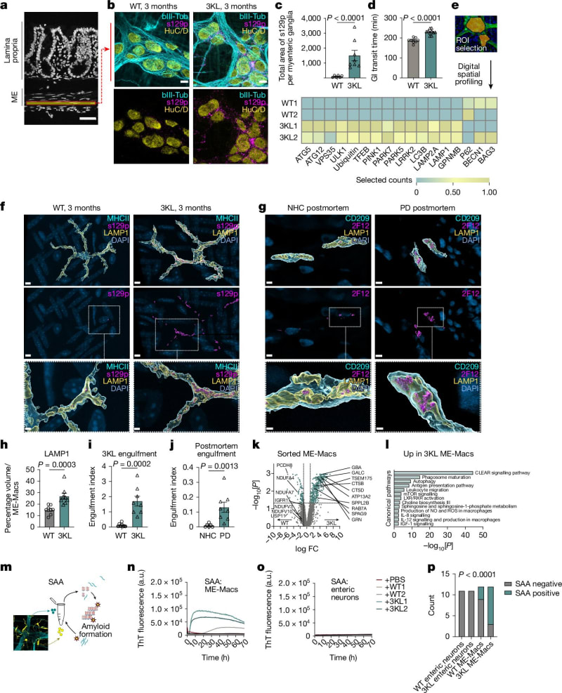 Gut Immune Cells May Stop Parkinson's Before Brain Damage