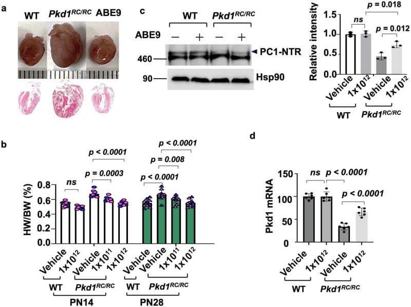 Single Gene Edit Treats Inherited Kidney Disease in Mice