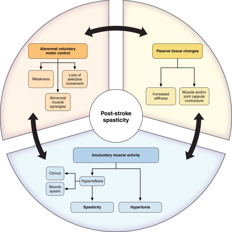 New Guidelines Help Stroke Survivors Recover Movement Faster
