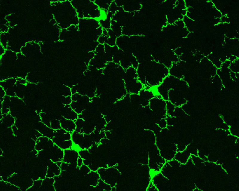 Microscope image showing healthy mouse microglia brain immune cells with branching tree-like structures in vibrant colors