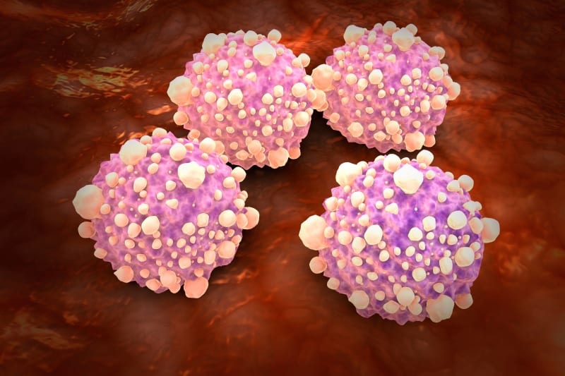 German Scientists Find Way to Expose Hidden Pancreatic Tumors - Image 2