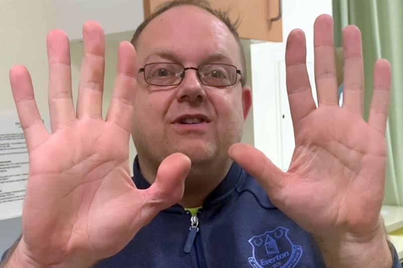 Cobbler Loses Thumb, Replaces It With Toe, Keeps His Dream - Image 2