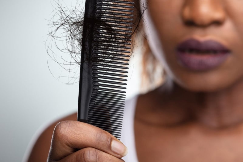 UK Court Rules Baldness Can Be a Disability for Women