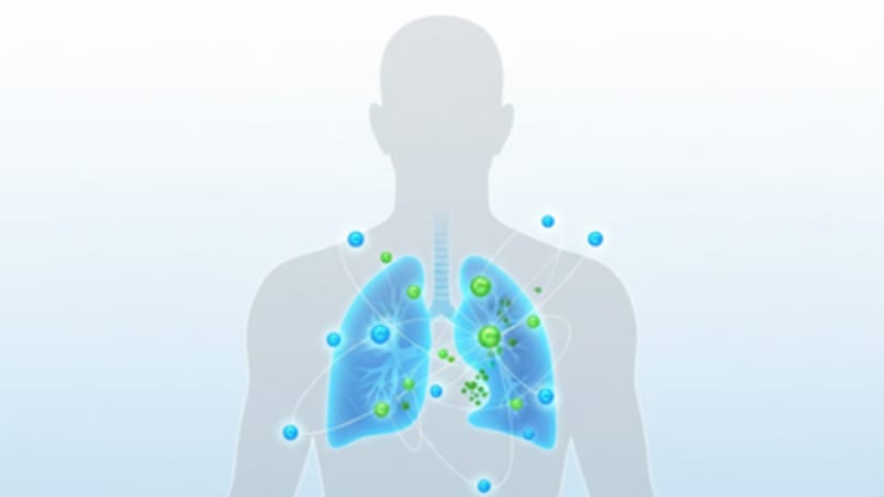 Saudi Arabia Approves First Lung Cancer Immunotherapy - Image 2