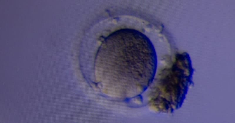 Embryologist examining viable egg found by automated OvaReady device during fertility treatment process
