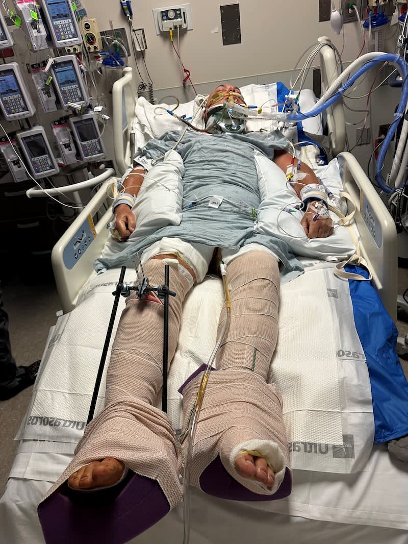 Hawaii Explosion Survivor Walks Again After 9 Broken Ribs - Image 2