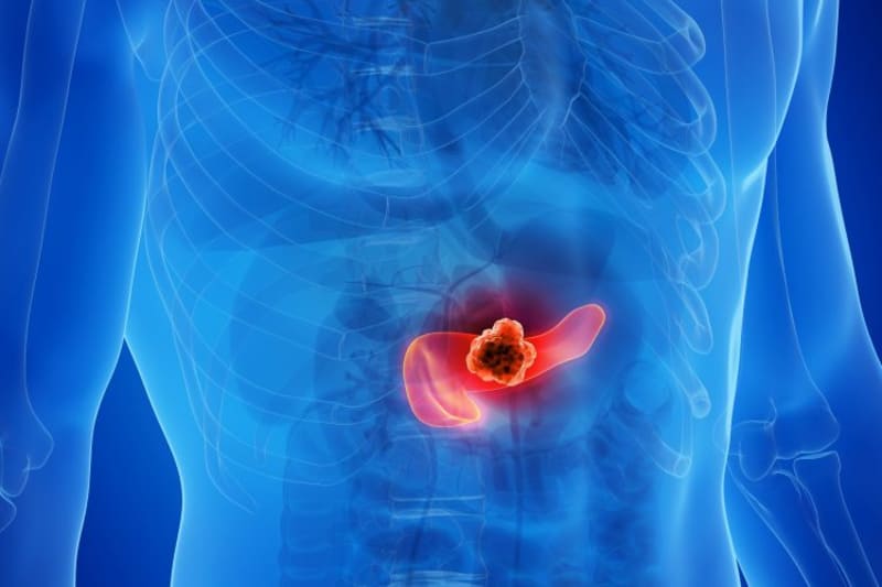 New Drug Combo Shrinks Pancreatic Tumors in Mice - Image 2