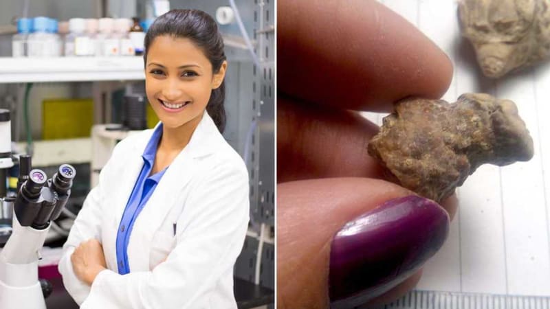 Magnetic Rice-Sized Robots Dissolve Kidney Stones in Days - Image 5