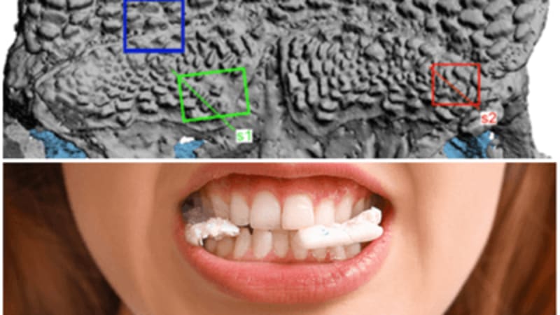 Magnetic Rice-Sized Robots Dissolve Kidney Stones in Days - Image 3