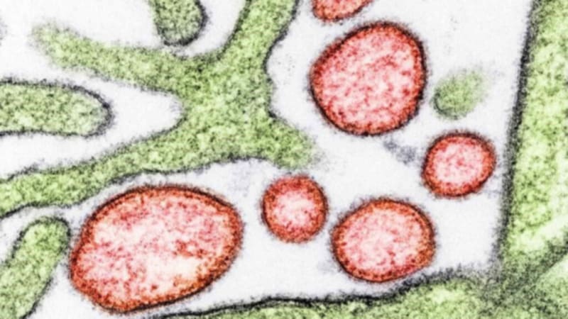 First Nipah Virus Vaccine Enters Human Trials in April - Image 2