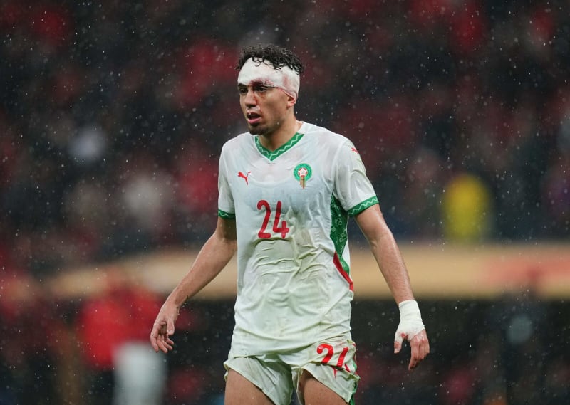 Morocco's El Aynaoui Shines Despite Controversial Final Loss