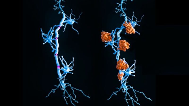 Groundbreaking Discovery Could Transform MS Treatment for Millions - Image 2