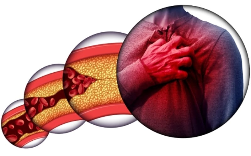 New Pill Cuts Cholesterol 60% Without Painful Injections - Image 3