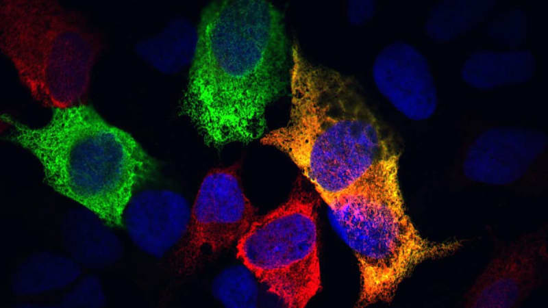 Scientists Find Cell Process That May Slow Aging