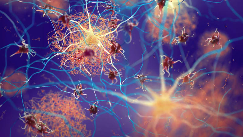 3D illustration of brain neurons with glowing receptor sites being activated to clear protein plaques