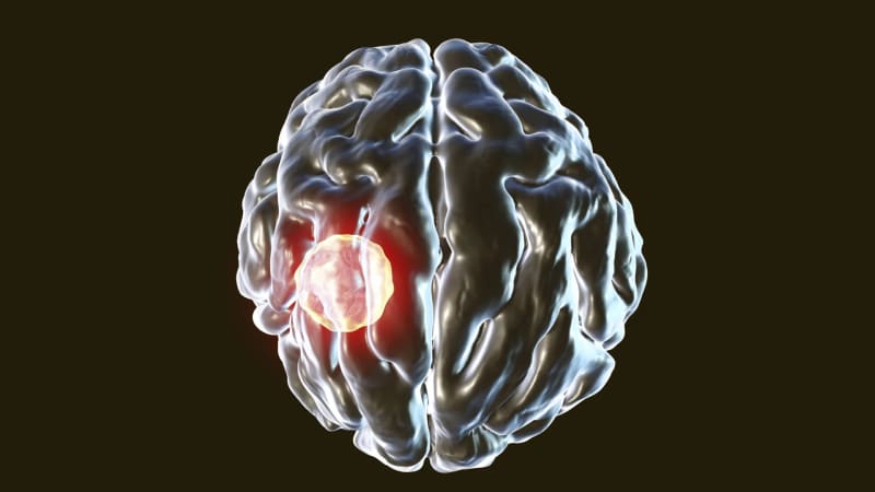 Brain Parasite Meets Its Match in Your Immune System