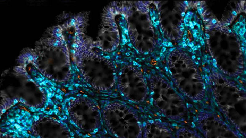 Scientists Discover Groundbreaking Way to Heal Aging Digestive Systems