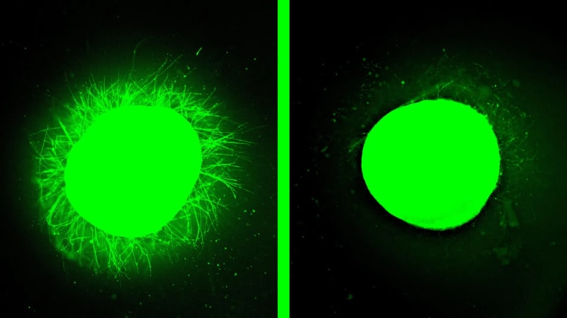 Lab-Grown Spinal Cord Heals After Injury at Northwestern